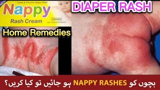 Diaper Rash and Home Remedies | Nappy Rash and Its solution| How to cure Pamper Rash