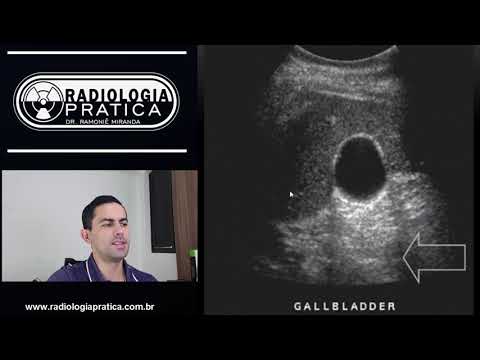 Ultrassonografia: conceitos básicos (formação da imagem ecográfica)... #ULTRASSONOGRAFIA