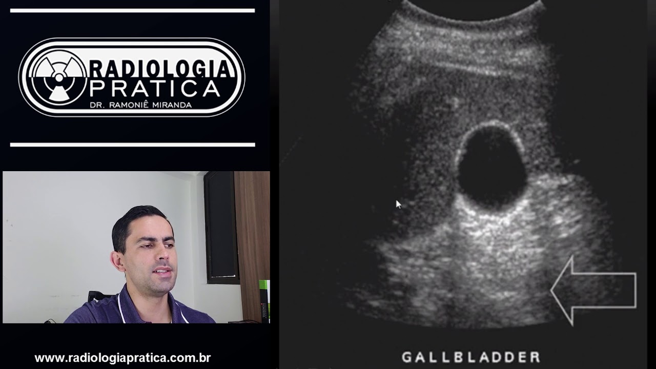 Ultrassonografia: conceitos básicos (formação da imagem ecográfica)... #ULTRASSONOGRAFIA