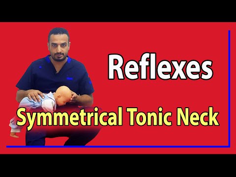 07 Symmetrical Tonic Neck Reflex