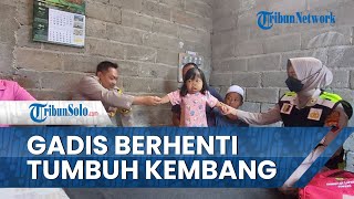 Kisah Sedih Gadis 15 Tahun Berhenti Tumbuh Kembang, Tubuh dan Pola Pikir seperti Bayi
