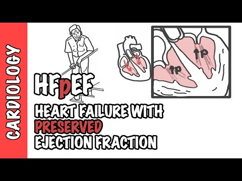 HFpEF – Herzinsuffizienz mit erhaltener Ejektionsfraktion