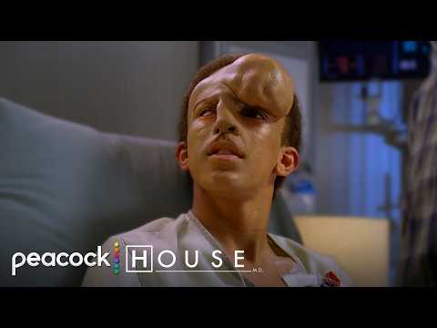 Heart Attack Stops Life Changing Facial Reconstruction Surgery | House M.D.