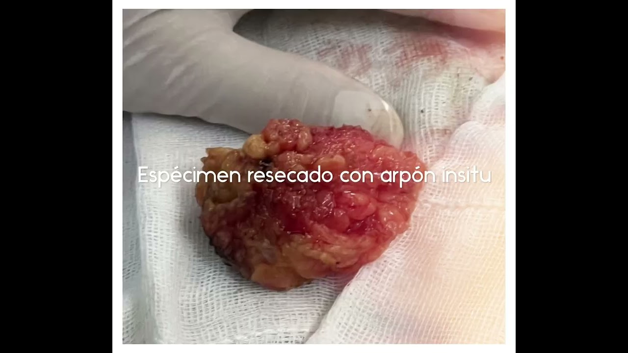 Ángel Millán Juárez-80