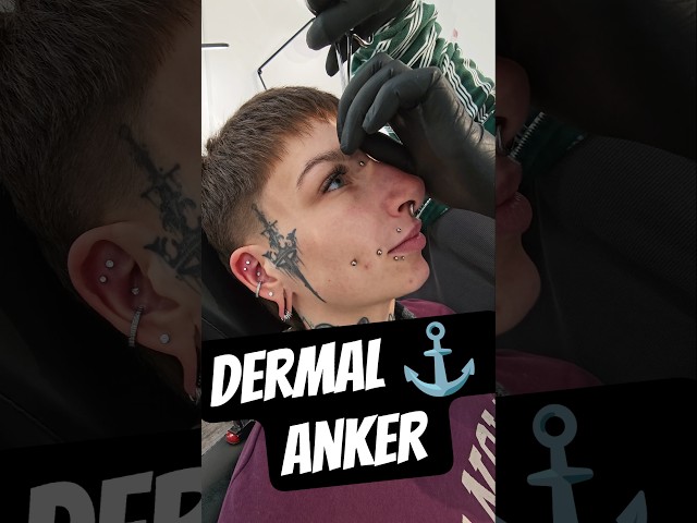 Vídeo relacionado con WARRIOR Piercing estéril Dermal Anchor Barbell Titanio G23 Barra Surface con discos 14G (1,6 mm) con dos bolas de 5 mm (PTS-04), Titanio
