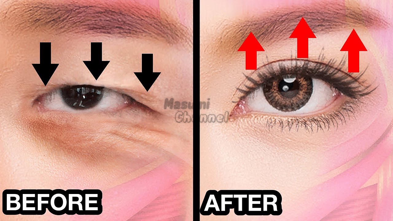 28 min🔥 Anti-Aging Eye Lifting Massage For Eye Bags, Sunken Eyes, Bigger Eyes, Dark Circles