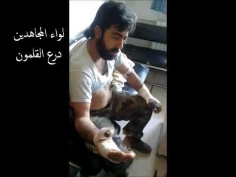 مقابلة مع قائد كتيبة الحسن التابعة للواء المجاهدين بعد إصابته بمعركة السيطرة على كتيبة للدفاع الجوي في قرية جبعدين في ريف دمشق