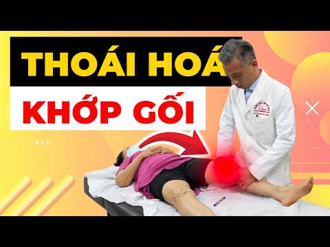 Thoái hoá khớp gối độ 3: Tại sao càng nghỉ càng đau hơn?