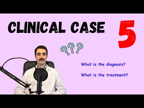 How do you manage this case? - Clinical case simulation
