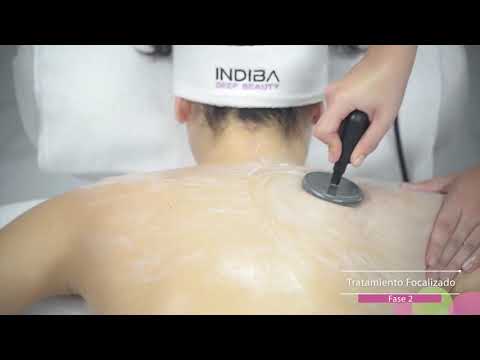 Tratamiento para espalda con INDIBA