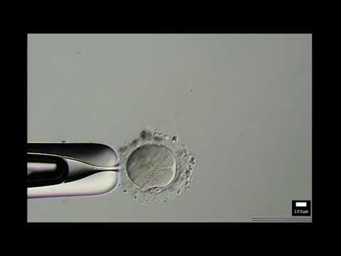 ICSI- การปฏิสนธิภายนอกร่างกาย #เด็กหลอดแก้ว
