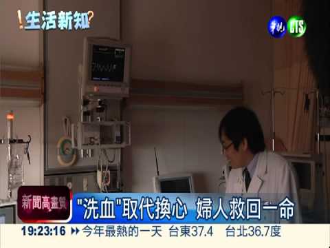 高齡產婦心衰竭 "洗血"免換心