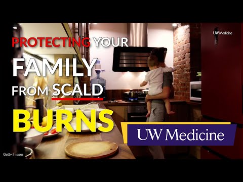 Children are at highest risk for a scald burn | UW Medicine