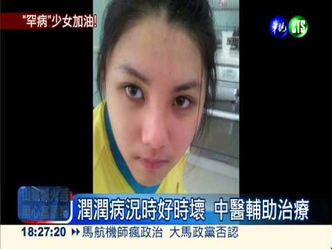 身心退化潤潤 針灸16次喜見好轉