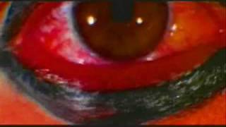 Mondo Pazzo: "Phasors on Stun"