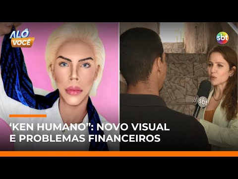 “Ken Humano” enfrenta dificuldades; com novo visual, veja como rapaz está | #AloVoce