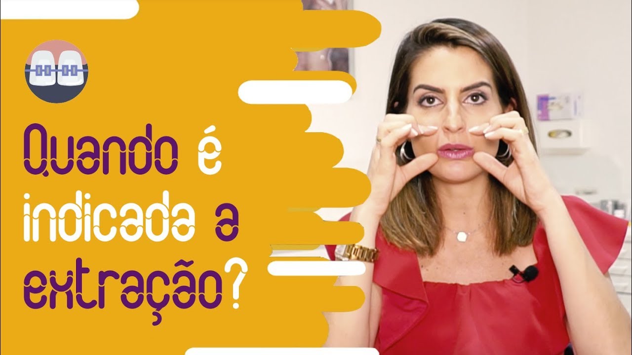 Quando é necessário extrair pré-molares durante o tratamento?