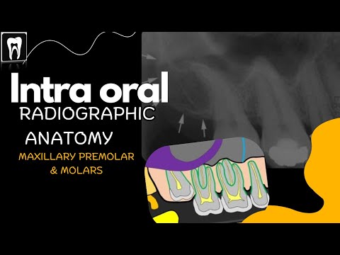 Intra Oral Anatomy/ Normal radiographic anatomical landmarks/Maxilla premolar and molar region