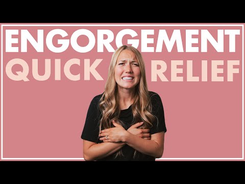 BREAST ENGORGEMENT RELIEF | Avoid Clogged Milk Ducts + Mastitis