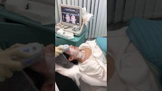 Ultherapy 旺季