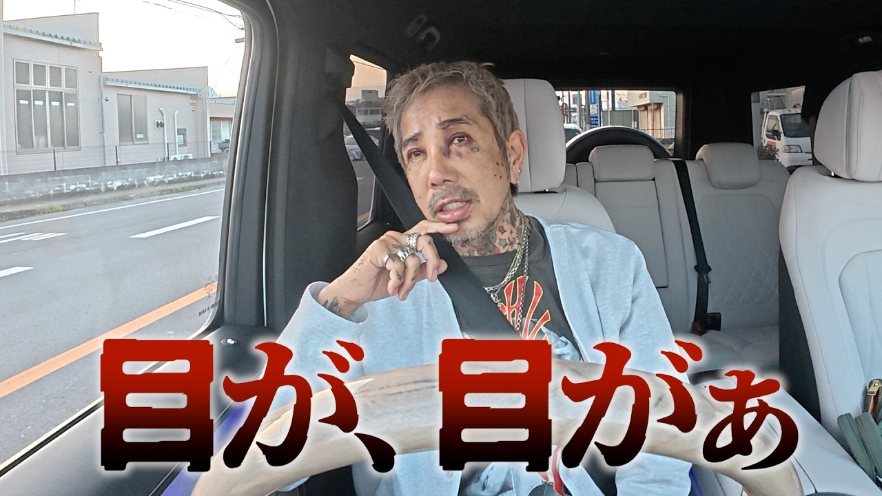 目が。、目がぁ....経過お見せします。