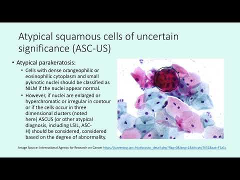 Cervical Cytology #2