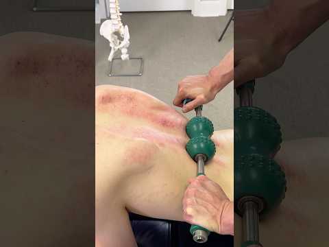 LOUD *CRACKS* 😳 Steamrolling A Tight Back!! #shorts #chiropractor