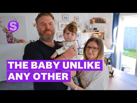 This baby has a condition so rare they may be the only one in the world to have it | Stuff.co.nz