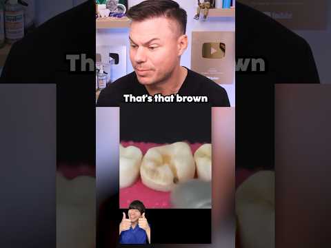 Why You Should BRUSH Your Teeth! 🦷🪥