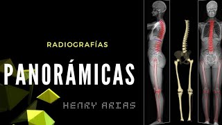 RADIOGRAFIA PANORÁMICA