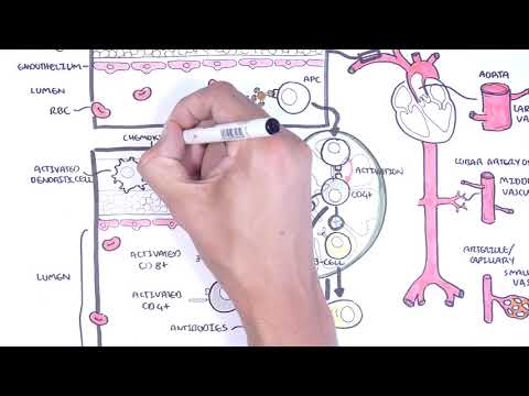 Fisiopatología de la vasculitis