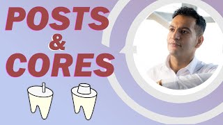 Posts and Cores with Dr Dij | Discussion & Case