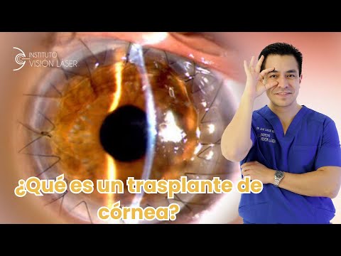 ¿Qué es el trasplante de córnea?