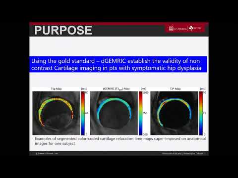 How does cartilage evaluation in T1Rho compare to dGEMRIC in patients with hip DDH?