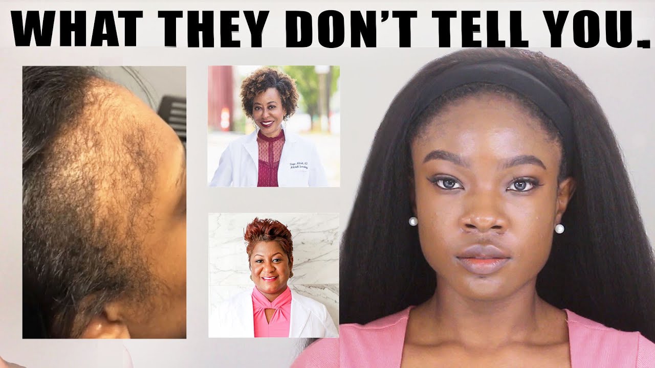 How to Actually Grow EDGES BACK| Real Dermatologists' Breakdown