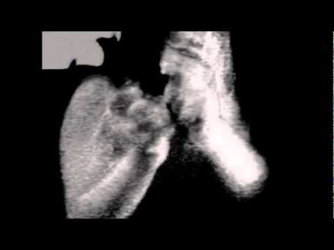 A Distortionz   W1ggOut