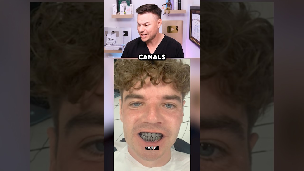 Dentist Reviews Turkey Teeth Transformation! 😮🦷