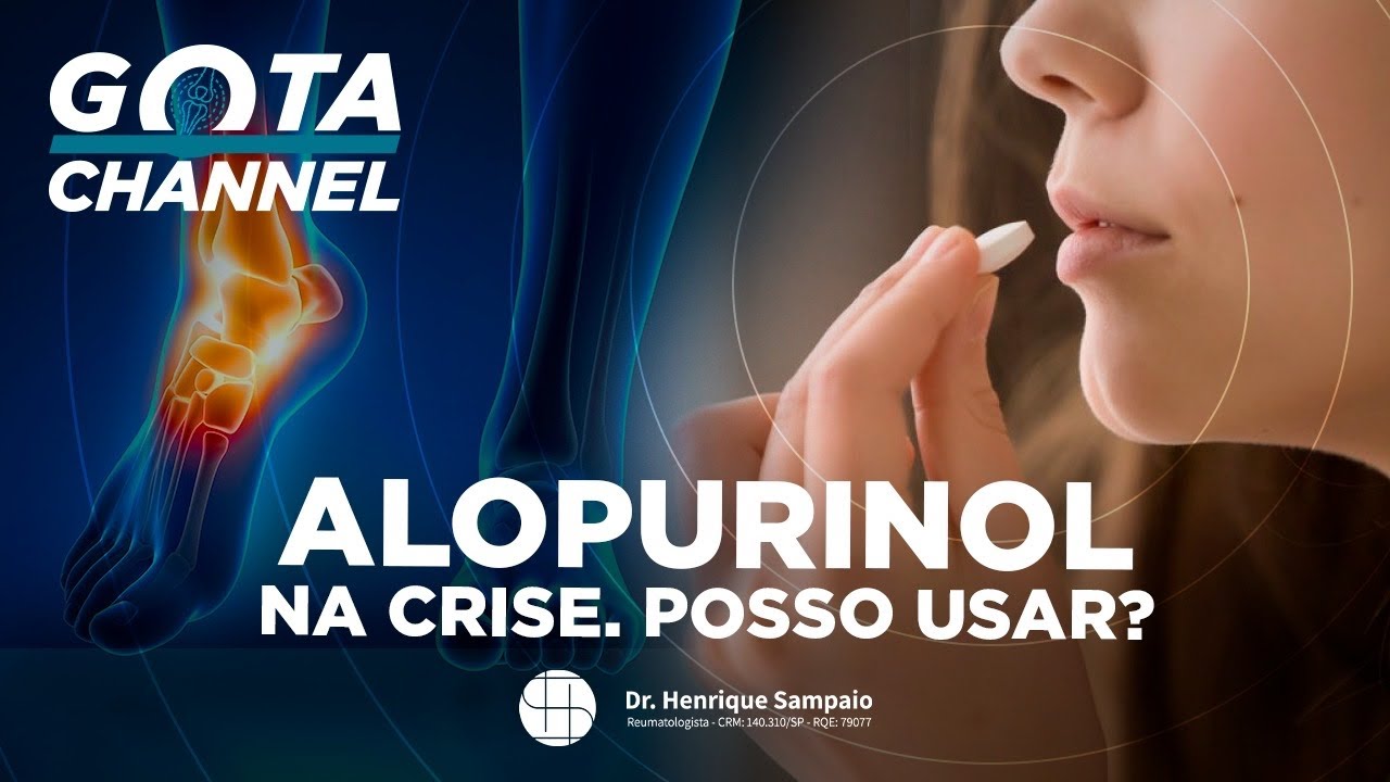 Devo USAR ou RECEITAR Alopurinol na crise de gota?