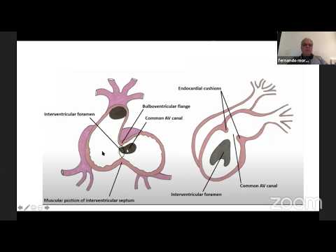 32º Virtual Meeting - Dr Fernando Moraes - Embriologia do Sistema Cardiovascular
