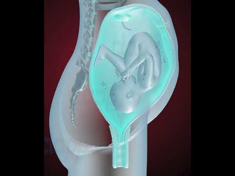 Fetus coming in to birth position (3D Animation)