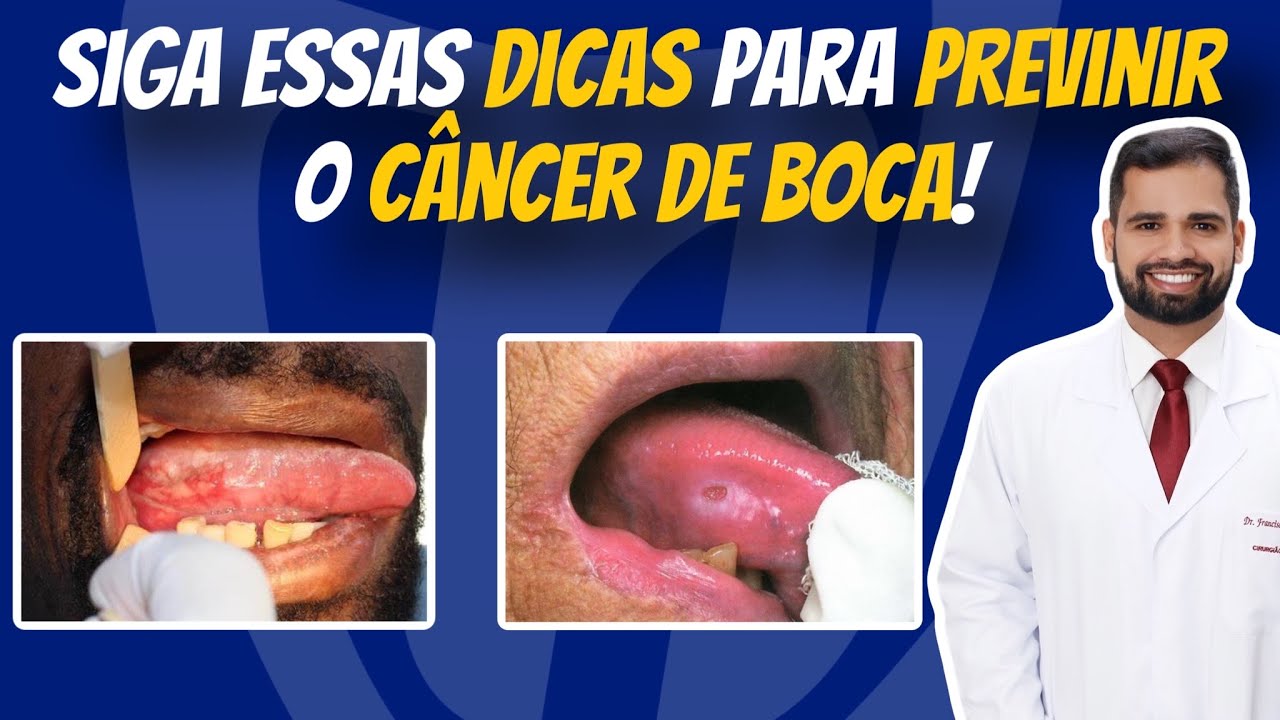 Francisco De Assis Almeida Lima Júnior-67