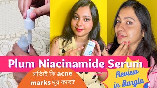 Download lagu Plum Niacinamide Serum Review | Best Niacinamide Serum? | acne marks কি দূর করে? #trellshop #plum mp3 Download lagu Plum Niacinamide Serum Review | Best Niacinamide Serum? | acne marks কি দূর করে? #trellshop #plum mp3