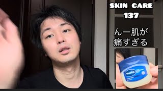 【スキンケア】137 ほんと肌がやばい、かゆい　痛い　で、ワセリン使うことにしました