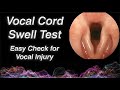 Vocal Cord Swell Test: Easy At Home Way to Check for Vocal Cord Injury