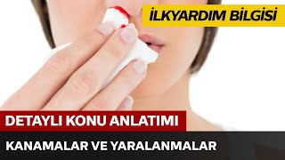 Kanamalar ve Yaralanmalar 