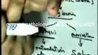 general pathology 24: congenital syphilis bilahrziasis1  DR SAMEH GHAZY