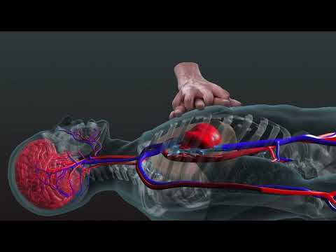 Romanian | Resuscitarea cardio-pulmonară | O privire tridimensională în interiorul corpului uman