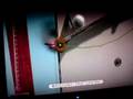 My LBP Level Beta Bar And Ball