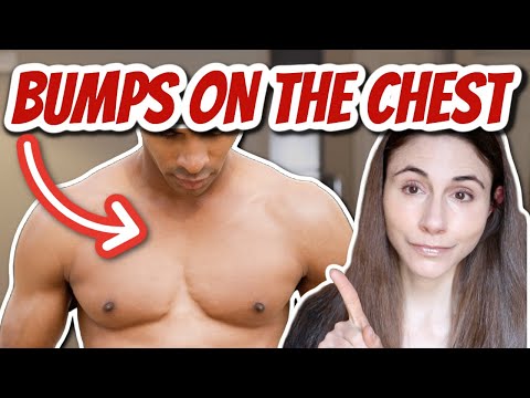 A Dermatologist's Guide To Understanding And Treating Bumps On The Chest That Are Not Acne.