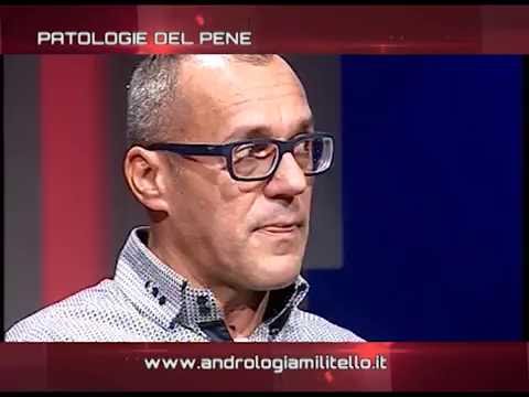 Il trattamento del cancro della prostata con SDA 2 Trattamento della prostatite farmaco Ucraina